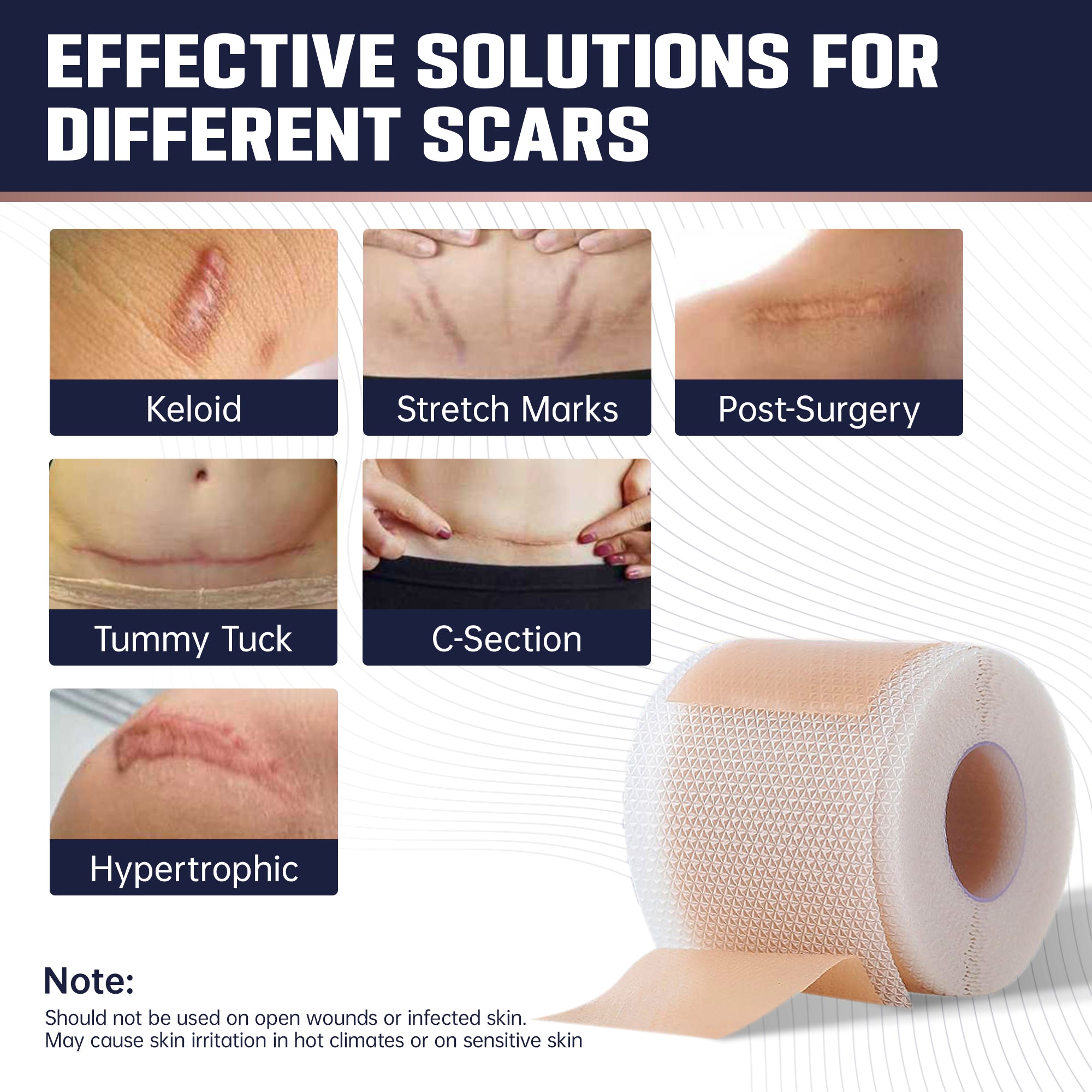 Silicone Scar Tape